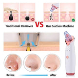 Top Quality Pore Vacuum Cleaner