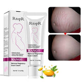 Top Quality Stretch Marks Cream