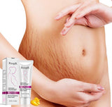 Top Quality Stretch Marks Cream